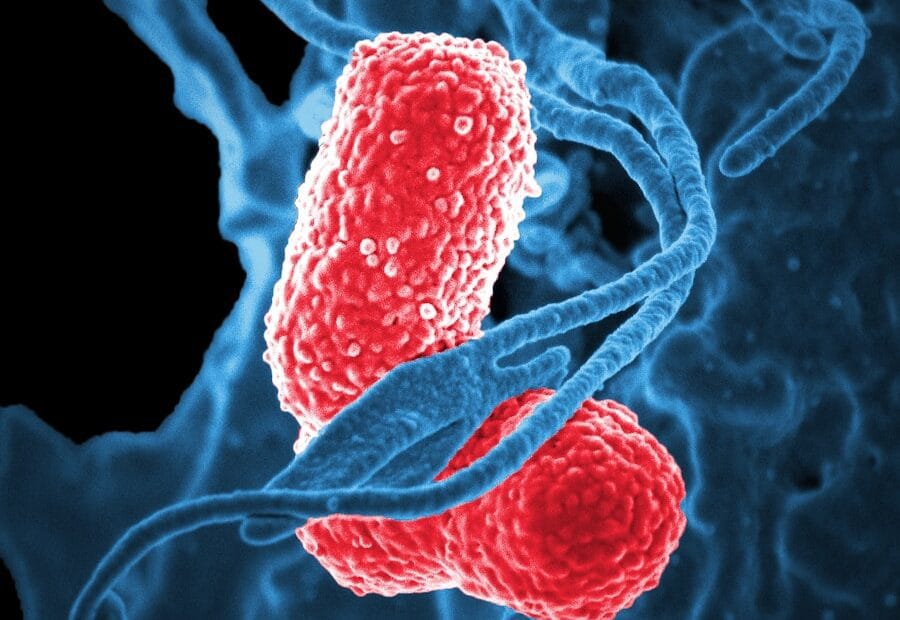 Photo Importance of Bowel Cancer Screening